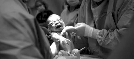 cesarean and vbac births, photo credit KellyMPhotography